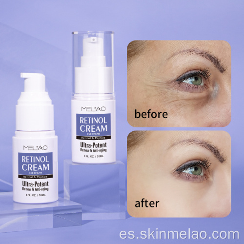 Remoción de la bolsa para los ojos crema de ojos de retinol anti envejecimiento